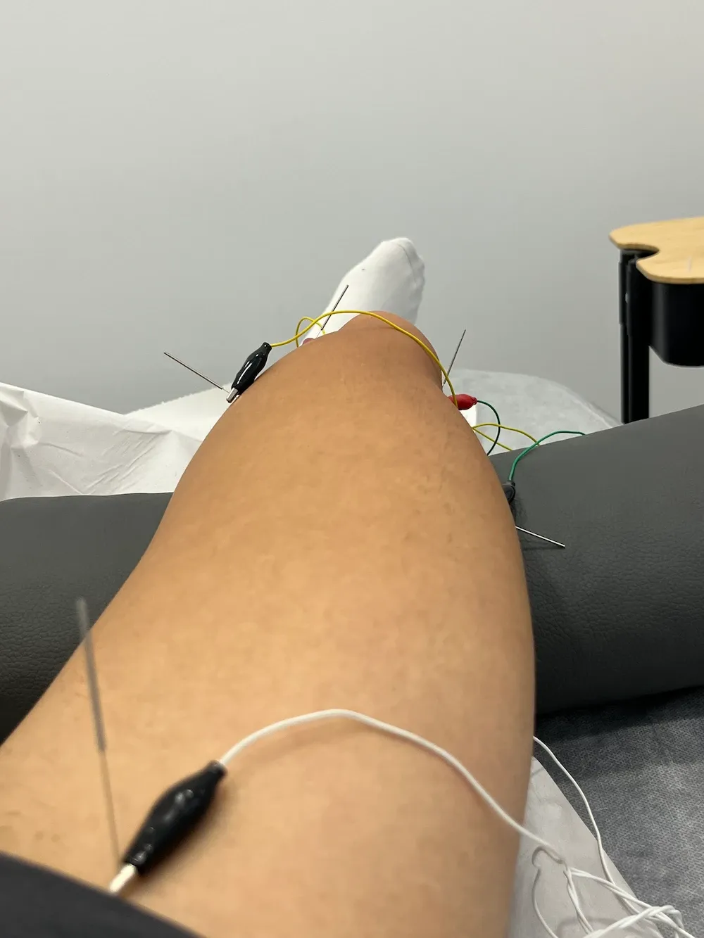 Técnicas Especializadas de Fisioterapia